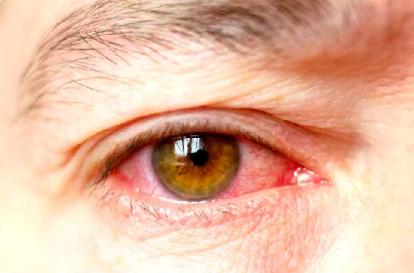 Saúde Ocular em Foco
