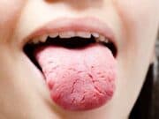 Sua língua está normal? Descubra os problemas de saúde que ela pode revelar língua problemas saúde