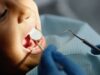 Zona Norte tem nove unidades do SUS com atendimento odontológico de urgência 24 horas. Listamos os endereços SUS Atendimento Odontológico