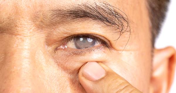 metanol bebida cegueira