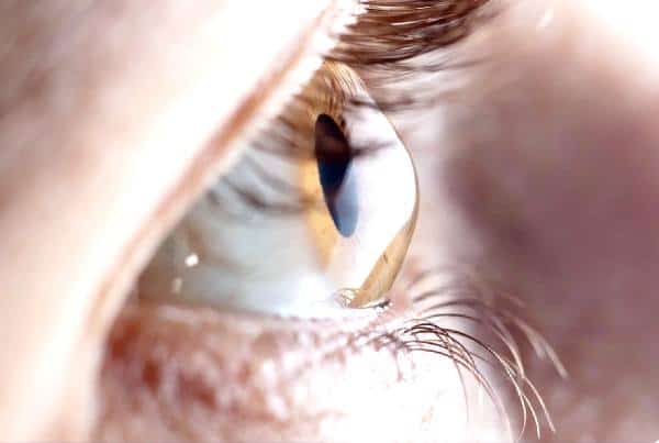 metanol bebida cegueira