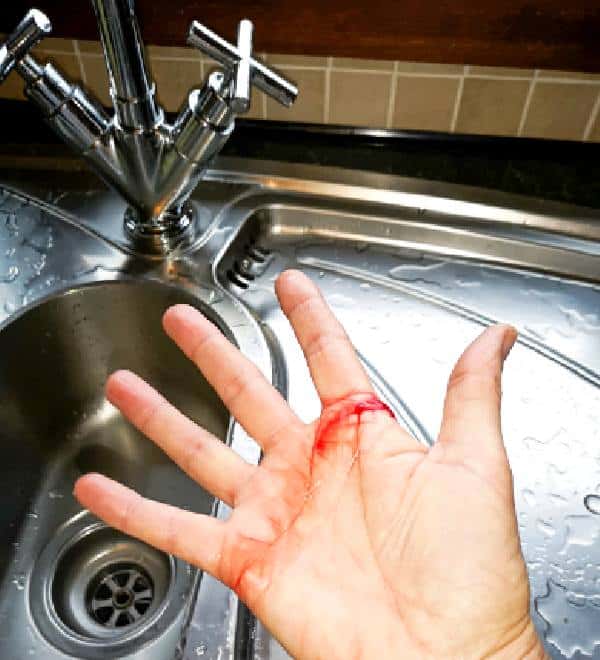 acidentes domésticos