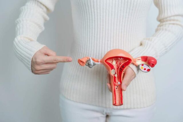 câncer colo útero endometriose