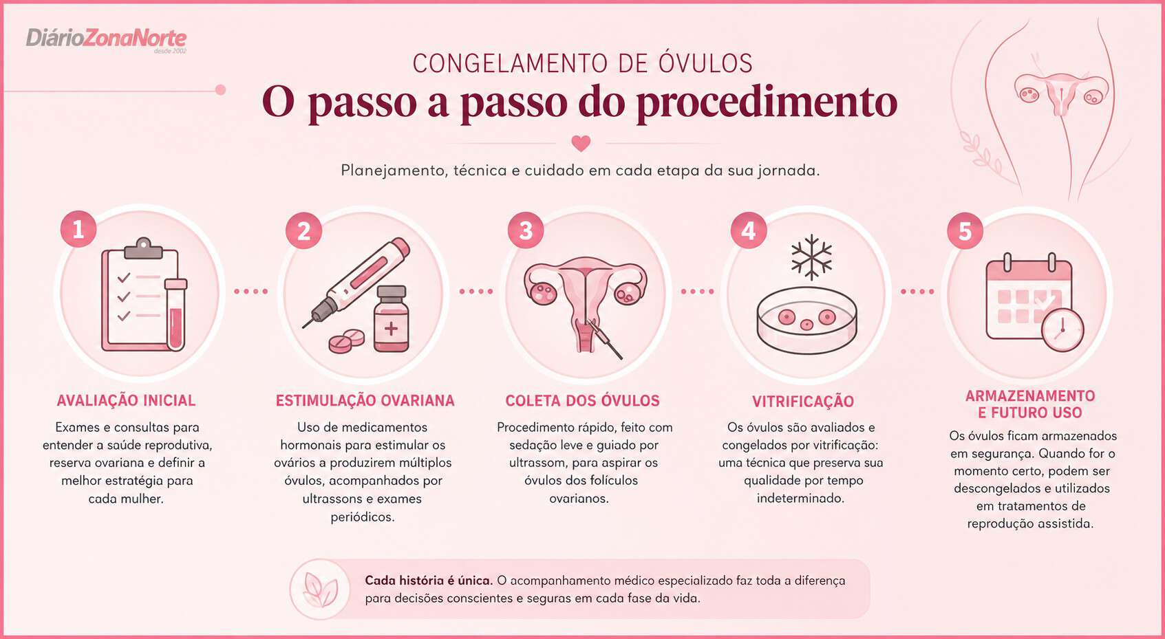 Congelamento óvulos quanto custa